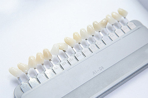 Dental Veneers